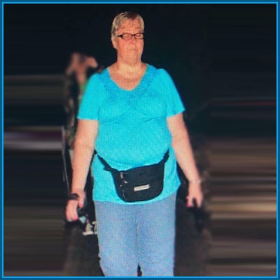Before image Brenda Sue Burk